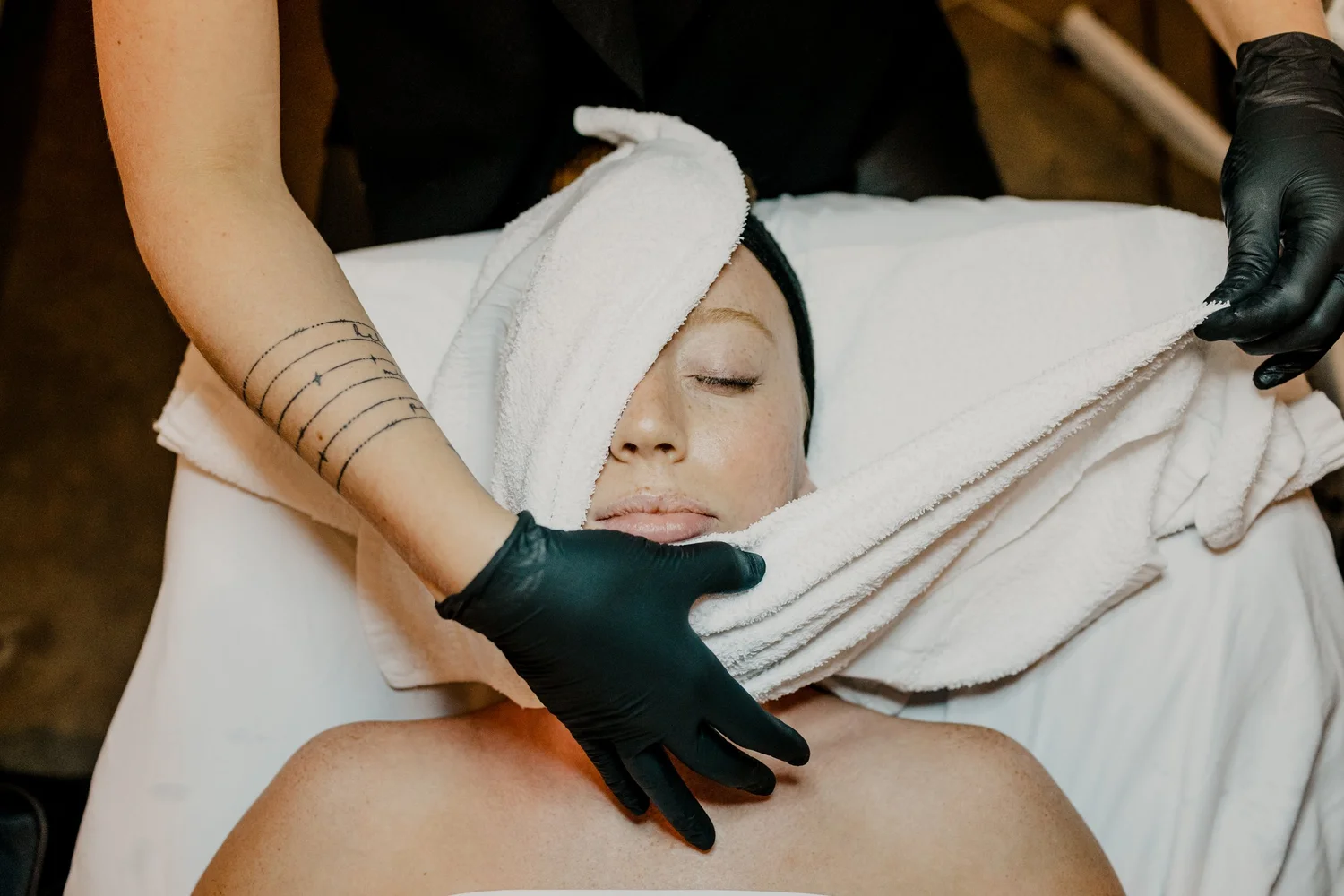Joanna’s acne journey: two years of consistency — TEMPLE Journal