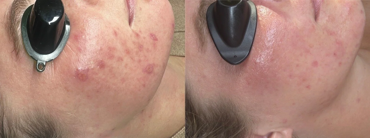 Your First Step: The Custom Facial at TEMPLE, Savannah
